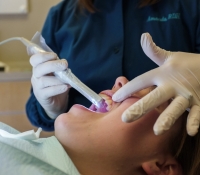 Intraoral camera at Avon Dental
